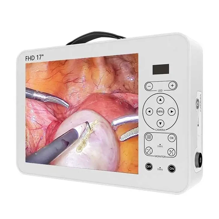 Système de caméra endoscopique portable médical